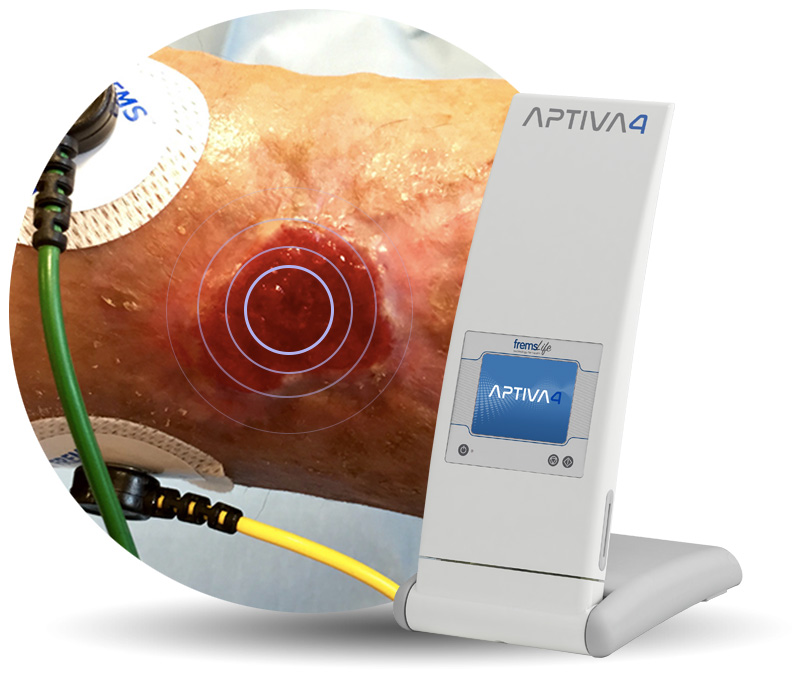 Aptiva4, Fremslife, tecnology for health, dispositivi per la salute e il benessere, Genova